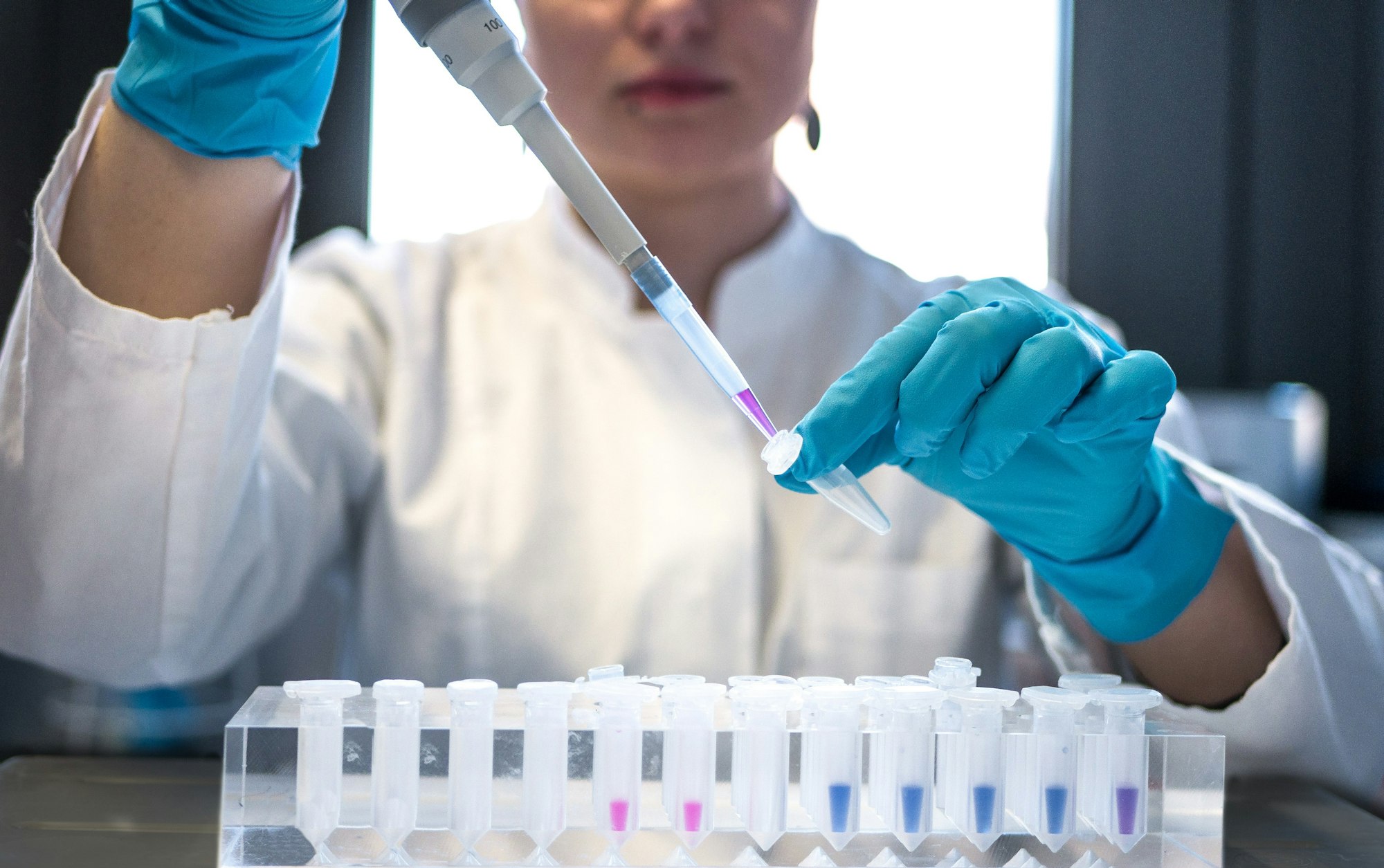 Laboratory scientist preparing liquid samples with a pipette